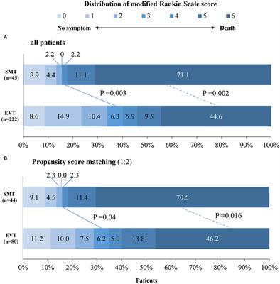 Endovascular treatment for distal basilar artery occlusion stroke